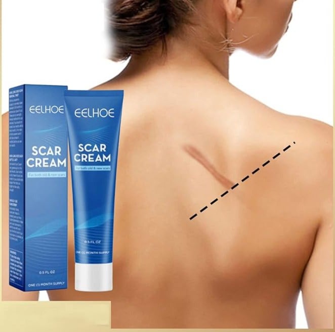 EELHOE Scar Cream For Both old & New Scars - Image 2